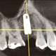 Illustration for article titled So, the dentist took a torque wrench to my face.